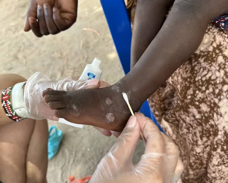 Bring Life Mission medical outreach serving a community in Kenya